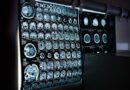 Cinco hospitales en Caracas donde ofrecen servicio de rayos X gratuito