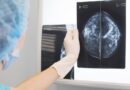 La Inteligencia Artificial podría ayudar a detectar el cáncer de mama