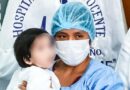 Gemelos siameses unidos por el vientre fueron operados con éxito en un hospital de Lima