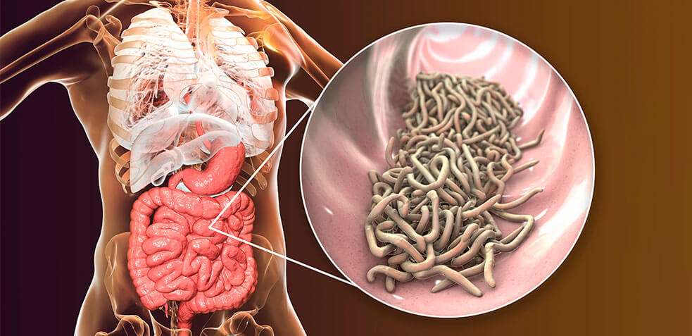 ¿Cómo detectar la infección por parásitos intestinales?